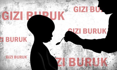 Menyelesaikan Darurat Nutrisi Anak sebagai Prasyarat Pertumbuhan Inklusif